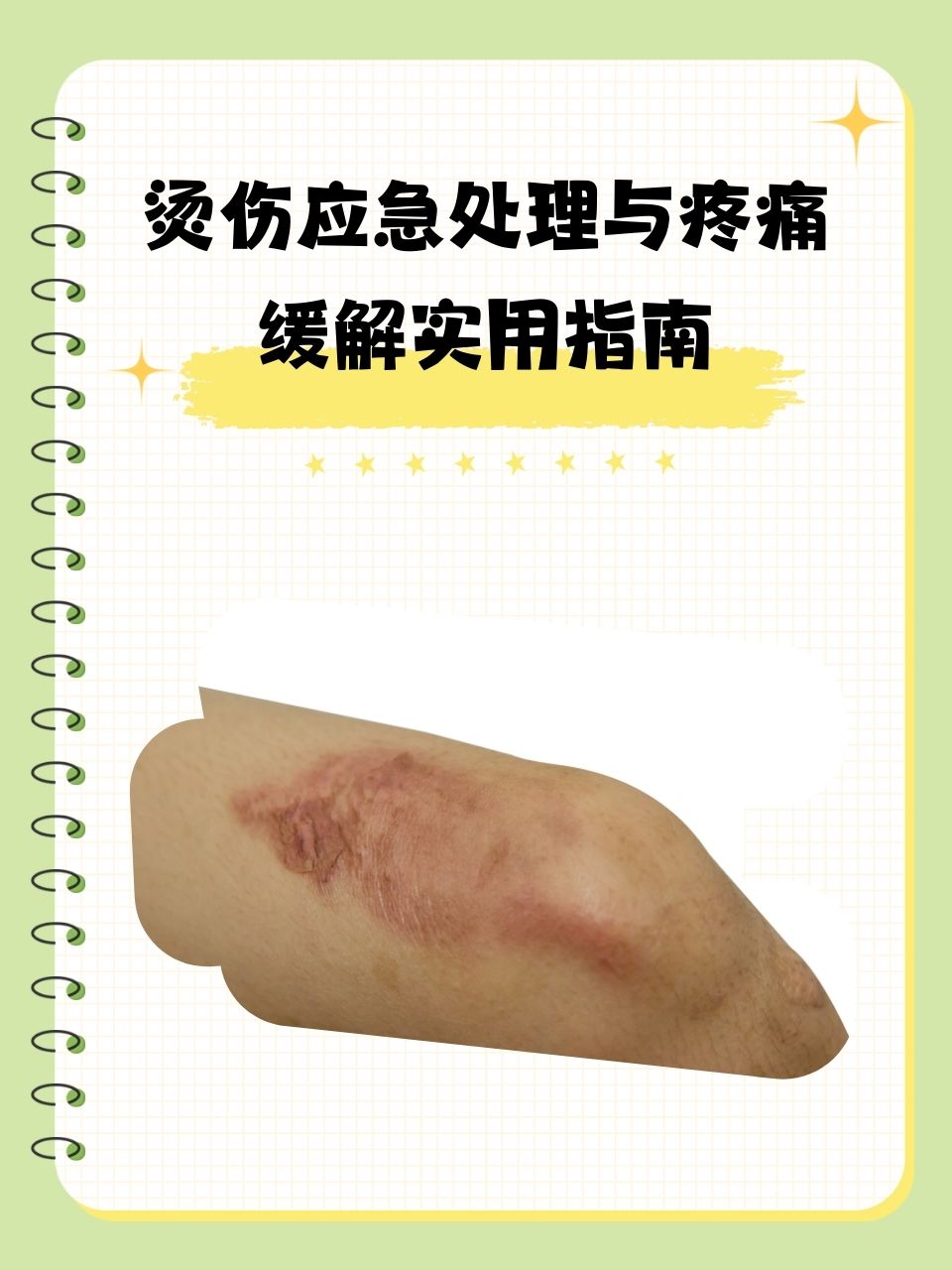 科技重塑女性健康，缓解痛经实用指南全攻略
